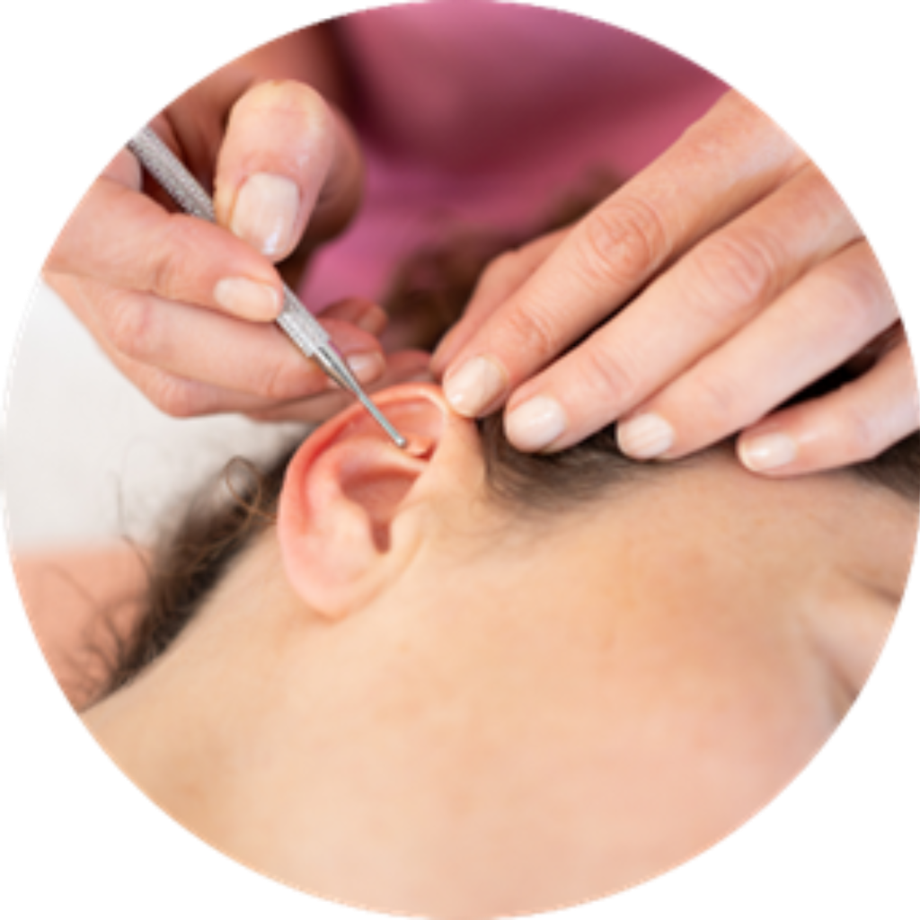 Curso De Auriculoterapia Básica