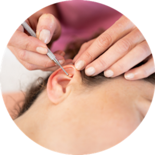 Curso De Auriculoterapia Básica